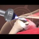 메디시스 의료기 이미지