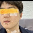 피어랑의원 이미지