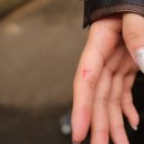 블루스팟 이미지