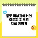 종로 피부과에서의 아토피 피부염 치료 이야기