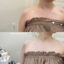 예봄인테리어 | 평택 팔뚝 승모근 관리 예봄뷰티 :: 보정X 아이폰 기본카메라 후기