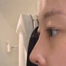 달코 | 코젤코 한달차 후기