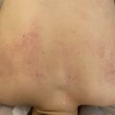 CW-1376-01 | [의정부 통증관리]미세전류를 통해 다이어트 지방제거 솔직후기 "누보레브"