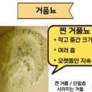 아침 소변 거품 과 단백뇨 거품뇨 원인 이미지