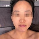 반송동100 | 동탄 반송동 피부관리 아이리뷰티, 파워브이리프팅 후기