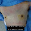 여유증 수술 후 병원 비용 선택 정보 확인하려면