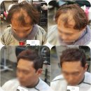 보노헤어(Bonohair)