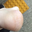 랑구네일 네이버블로그