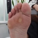 바른네일레푸스 이미지