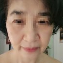 마필 | 대전피부관리 잘하는곳 전민동 아로마필 탱탱관리 받고온 후기