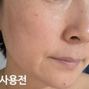 르니 | 르니브320탄력크림으로 완성하는 40대탄력크림 리얼 후기