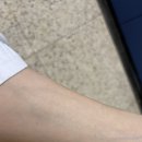 성거-05 | 신장이식 d+606 따봉토끼야 힘을내줘,,ㅠㅠ 올림픽 재밌네,,,