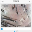 한올두피탈모