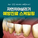 원흥치과 스케일링 지연하는 순간 잇몸이 변해요