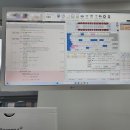 연산동 뷰티플란트 치과에서 충치 치료 – 레진 &amp; 인레이 솔직 후기, 가격공유