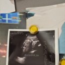 RT산전 | [척추측만증 필라테스 강사의 운동 일지] 나의 측만도 어쩌면 내 능력일 수 있겠다.(3)