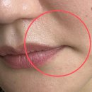 오빛나의원 이미지