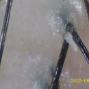 스너그라운드 | 모공에 굳은 기름, 나도 이런 상태였다고요? 경산 스너그라운드 두피스케일링 후기