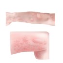 이웃집한의원 이미지