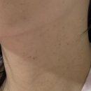 군자 루트여성의원 자연분만 출산 후기 -2/ 병실 후기 / 병원밥