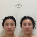 두경부화장 | 남양주 다산 윤곽관리 웨딩촬영 전 4번 받고 대만족 후기