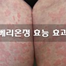 베리온베리