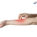 도봉제일의원 네이버블로그