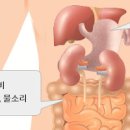 신경성위염 기능성위장장애 원인과 증상 이미지