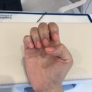 슬릿네일