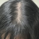 헤어 마스타 | [라라츄] 헤어쿠션 마스터 산후탈모로 휑한 정수리 커버 후기