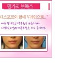 미고운