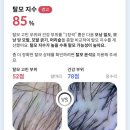 중앙공원1단계 방문자센터 | 부산 부산대 헤솔두피클리닉스 부산대두피관리 탈모관리 후기