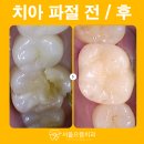 서울으뜸치과의원 이미지