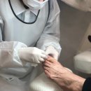 양주 내성발톱 엄지 통증 무작정 자르면 후회하는 이유