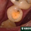 범플란트치과의원