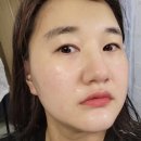 에프이티 이미지