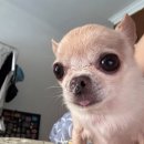 레이저 | 루비레이저 후기 :: 부작용/가격/딱지