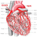 심장병 심정지 응급처치법 건강한 관상동맥 만들기 이미지