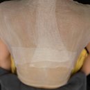 솔한의원 | 일산등드름 고민 끝, 솔에스테틱 일산점 리얼후기