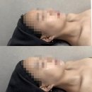 재영메디칼 | 전주에스테틱 &#39;올가드림뷰티 호성점&#39; 리프팅 초음파 관리 솔직 후기