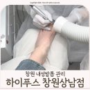 상남오거리 | 창원 내성발톱 문제성발톱 관리후기 [하이푸스 창원상남점]