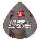 눈이 침침하고 자주 충혈된다고? 실명 초래하는 포도막염 예방법은? 이미지