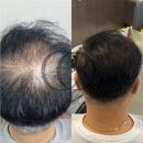 채오름SMP 이미지