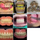 연치과기공소 이미지