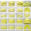 바른치과기공소 이미지