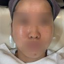 블랑미토탈뷰티 네이버블로그