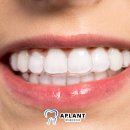 에이(A)플란트치과의원 이미지