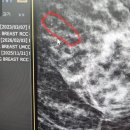 인천어바웃유외과의원 | 인천 송도근처 유방외과 미세석화화 검사할 수 있는 병원