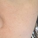 지재 | 엔엑스코드 NMN재생앰플 세콜지재생크림 솔직후기. 피부결 재생 느낌이 달라요