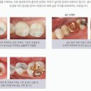 형치과의원 네이버블로그